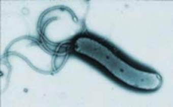 Helicobacter Pylori,    shef.ac.uk