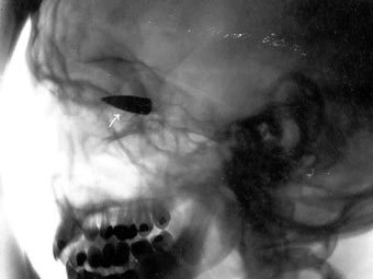     .    trauma.org
